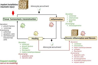 Modelling of macrophage responses to biomaterials in vitro: state-of-the-art and the need for the improvement